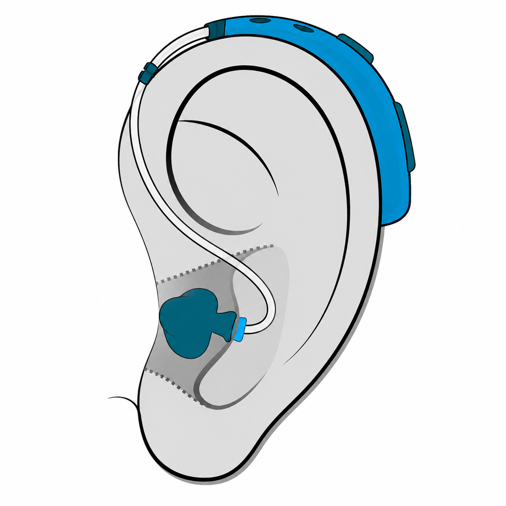 Behind-the-Ear (BTE) hearing aid style fitted at Precision Hearing in San Antonio, TX