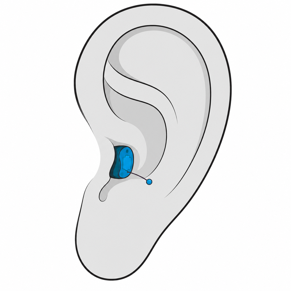 Completely-in-Canal (CIC) hearing aid style fitted at Precision Hearing in San Antonio, TX