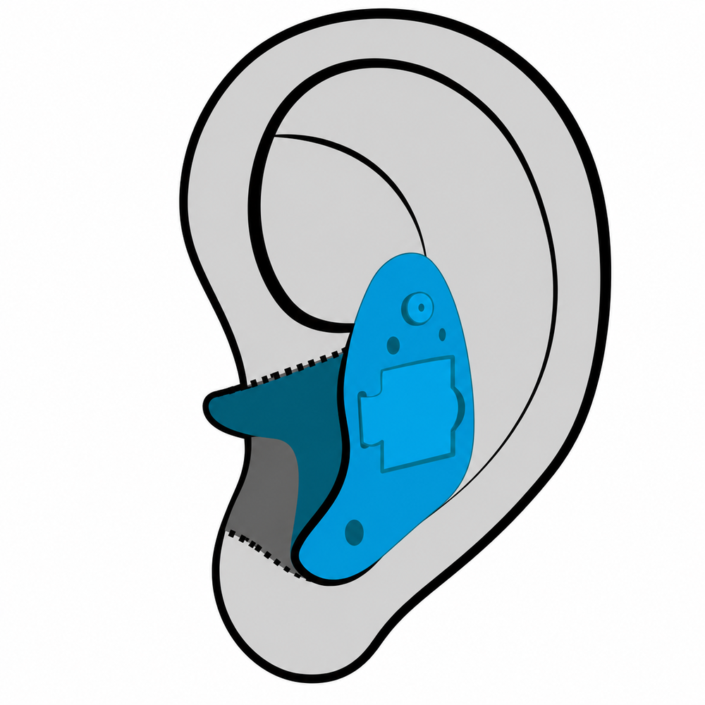 In-the-Ear (ITE) hearing aid style fitted at Precision Hearing in San Antonio, TX
