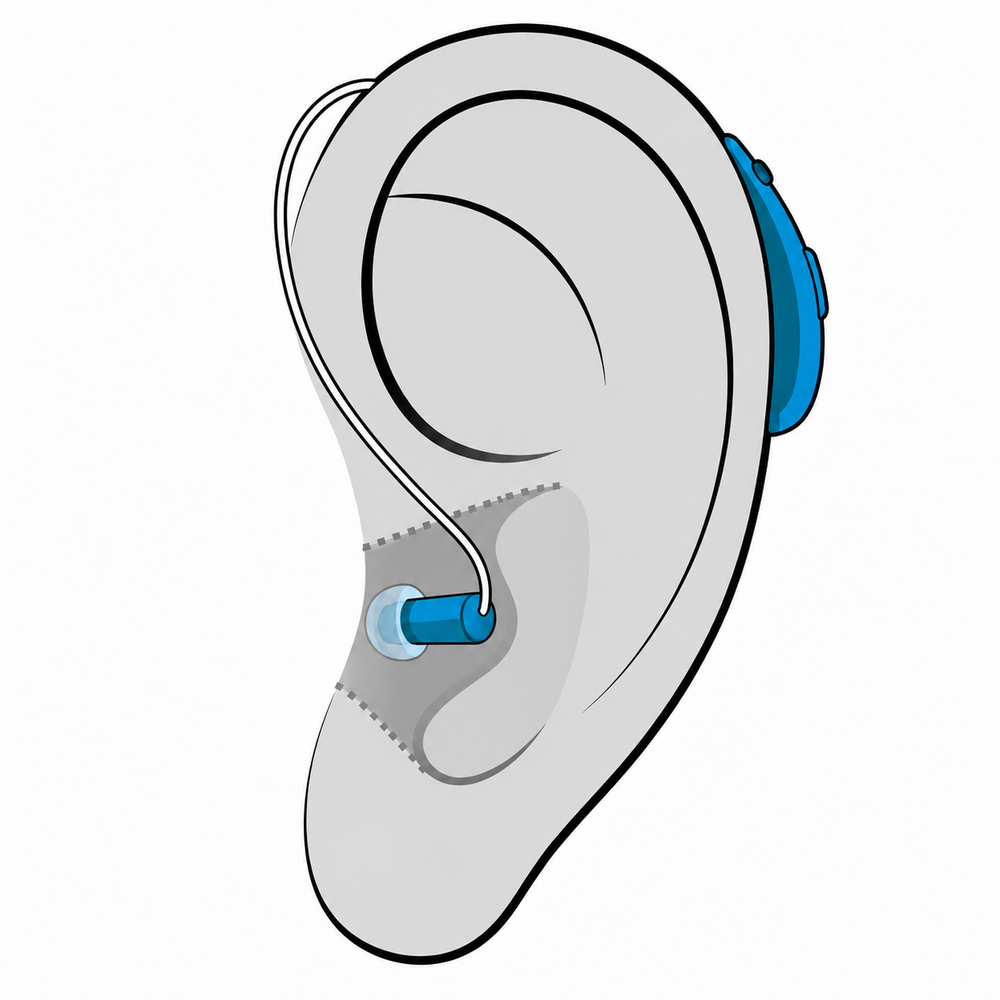Receiver-in-Canal (RIC) hearing aid style fitted at Precision Hearing in San Antonio, TX